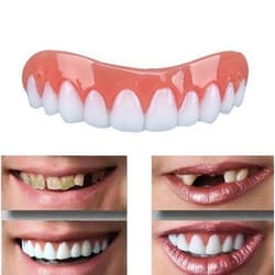 instant smile teeth cover, natural fit temporary teeth veneer snap on smile