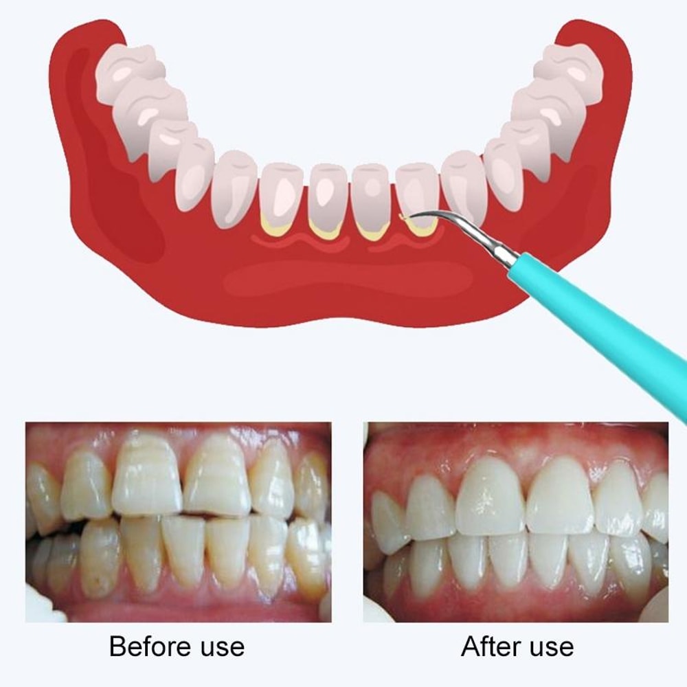 5Speed USB Rechargeable Electric Teeth Polisher Waterproof Dental Cleaning Tool 1