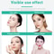 Stainless Steel Ice Roller For Face Cooling Facial Massager Skin Tightening Tool 3