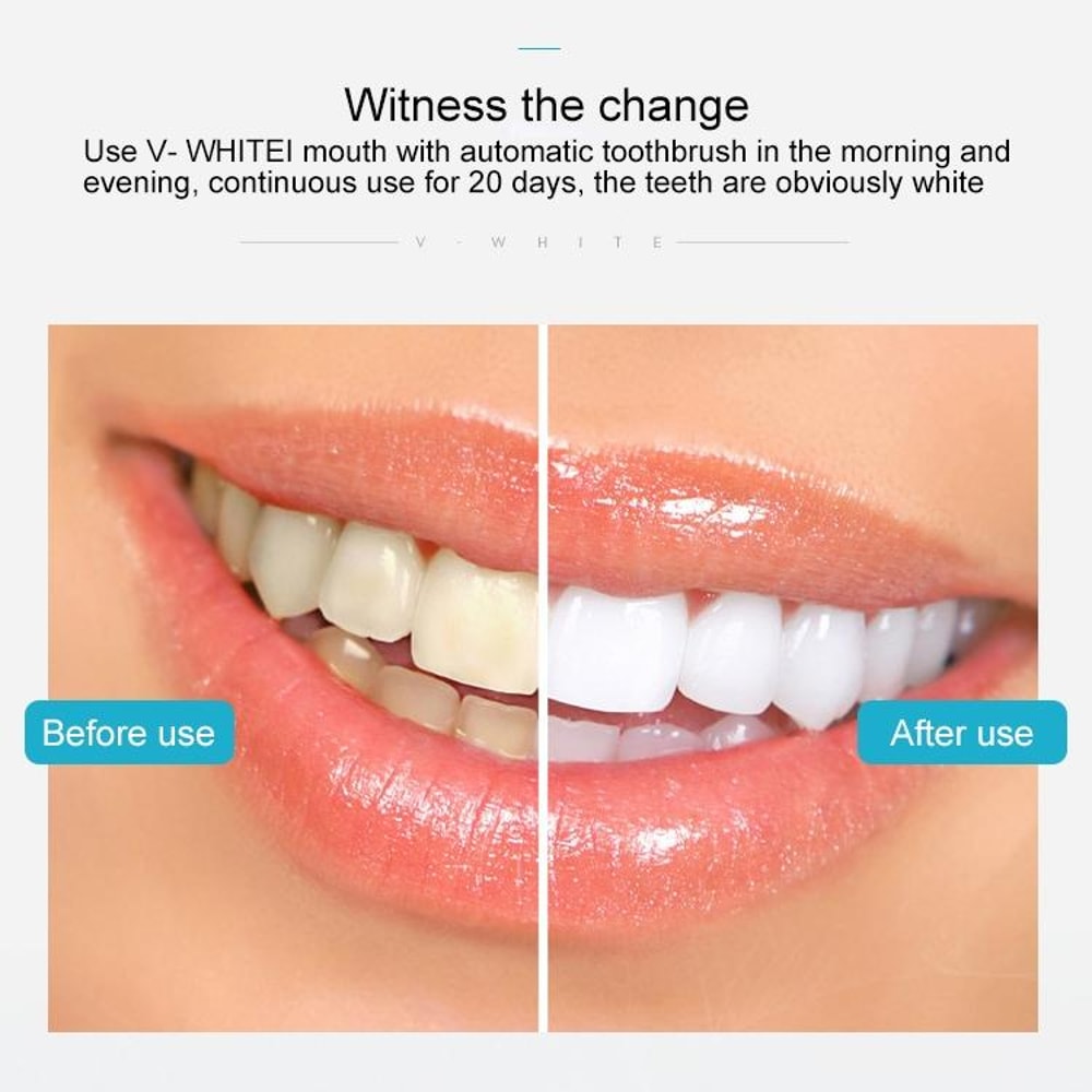 360 Automatic Silicone Electric Toothbrush With 3 Modes For Deep Clean Gum Care 3