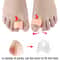 10 Pairs Soft Gel Toe Separators For Bunion Relief Toe Straightener Orthosis Cushion Set 2