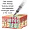 Smart Electronic Acupuncture Meridian Pen For Pain Relief Muscle Therapy 2