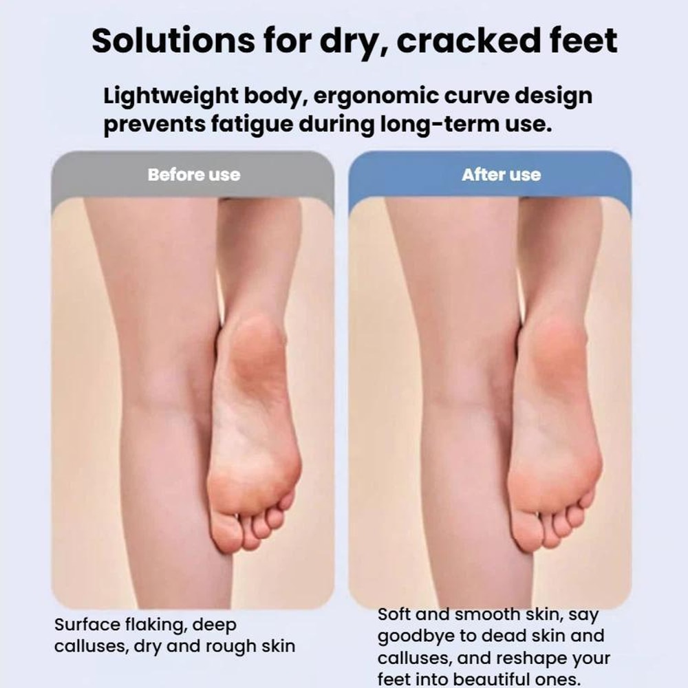 Smart Vacuum Electric Foot File With LCD Display Waterproof Callus Remover 7