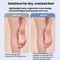 Smart Vacuum Electric Foot File With LCD Display Waterproof Callus Remover 7