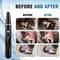 Ultrasonic Pet Teeth Cleaner Kit For Dogs Cats Plaque And Tartar Remover 3