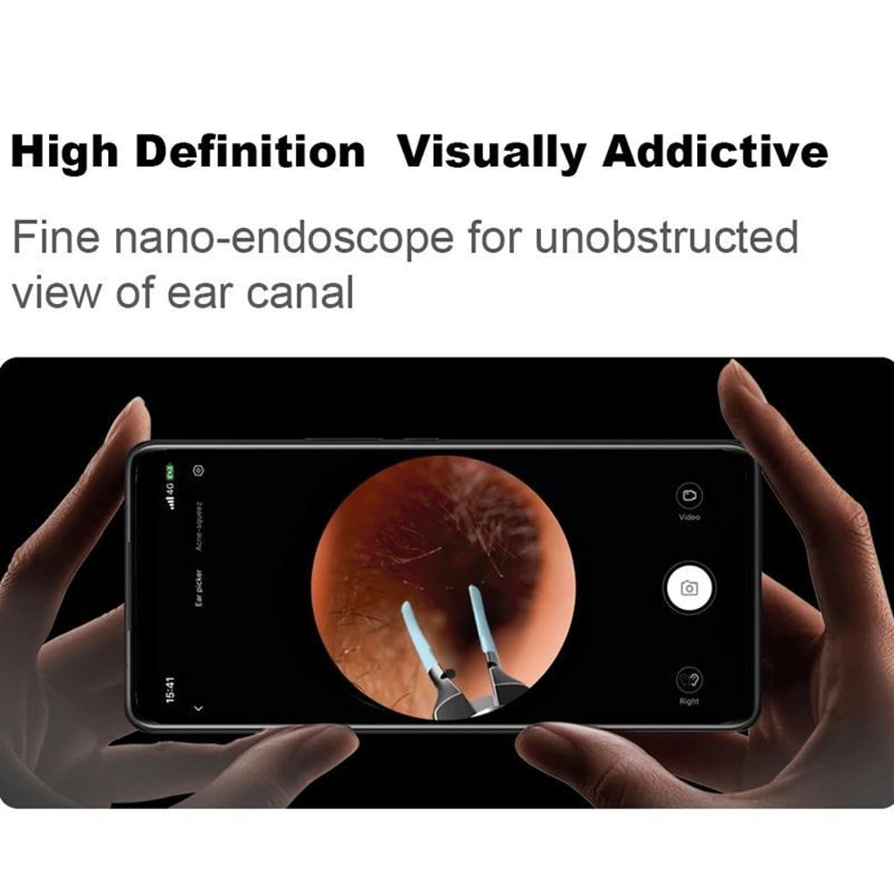 Smart Visual Ear Cleaner Camera Kit with Tweezers & Silicone Ear Wax Removal Tools