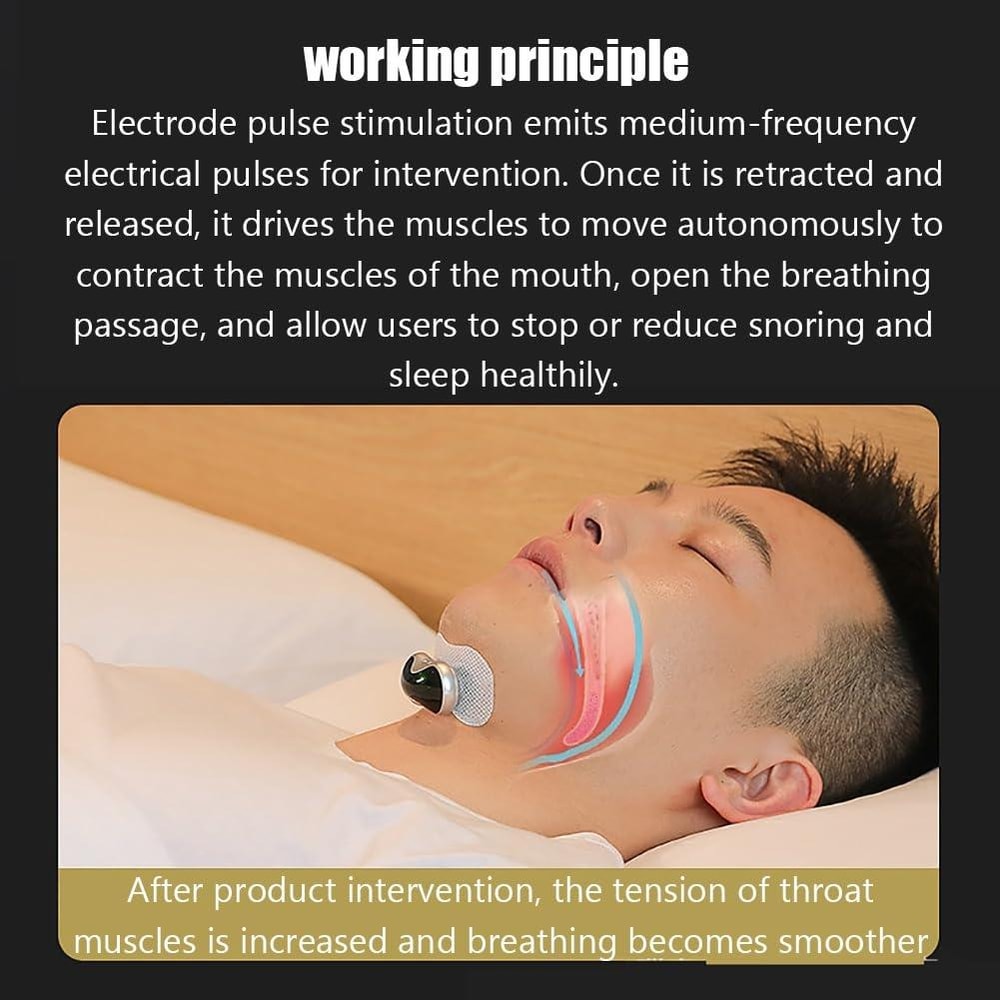Smart Anti Snoring Device With TENS Pulse Therapy Magnetic Charging For Better Sleep 5