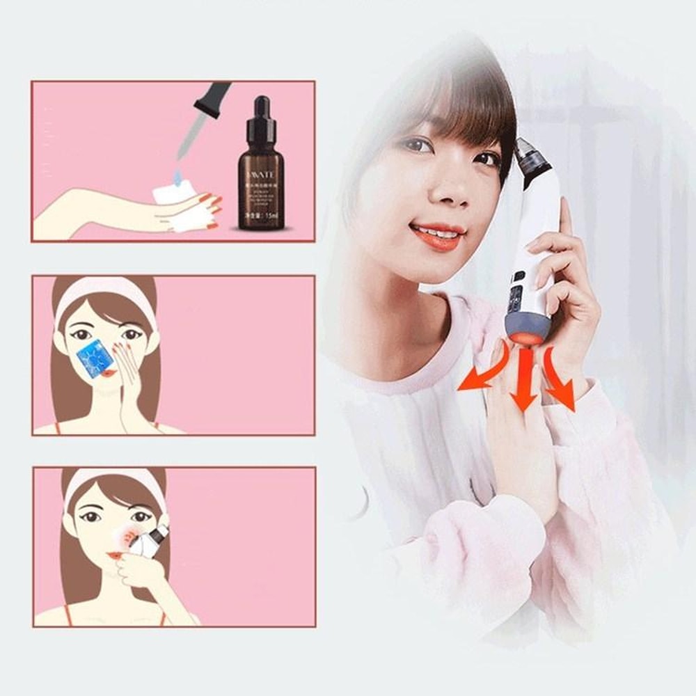 3-in-1 Heated Blackhead Remover with Temperature Sensor & Electric Pore Cleaner