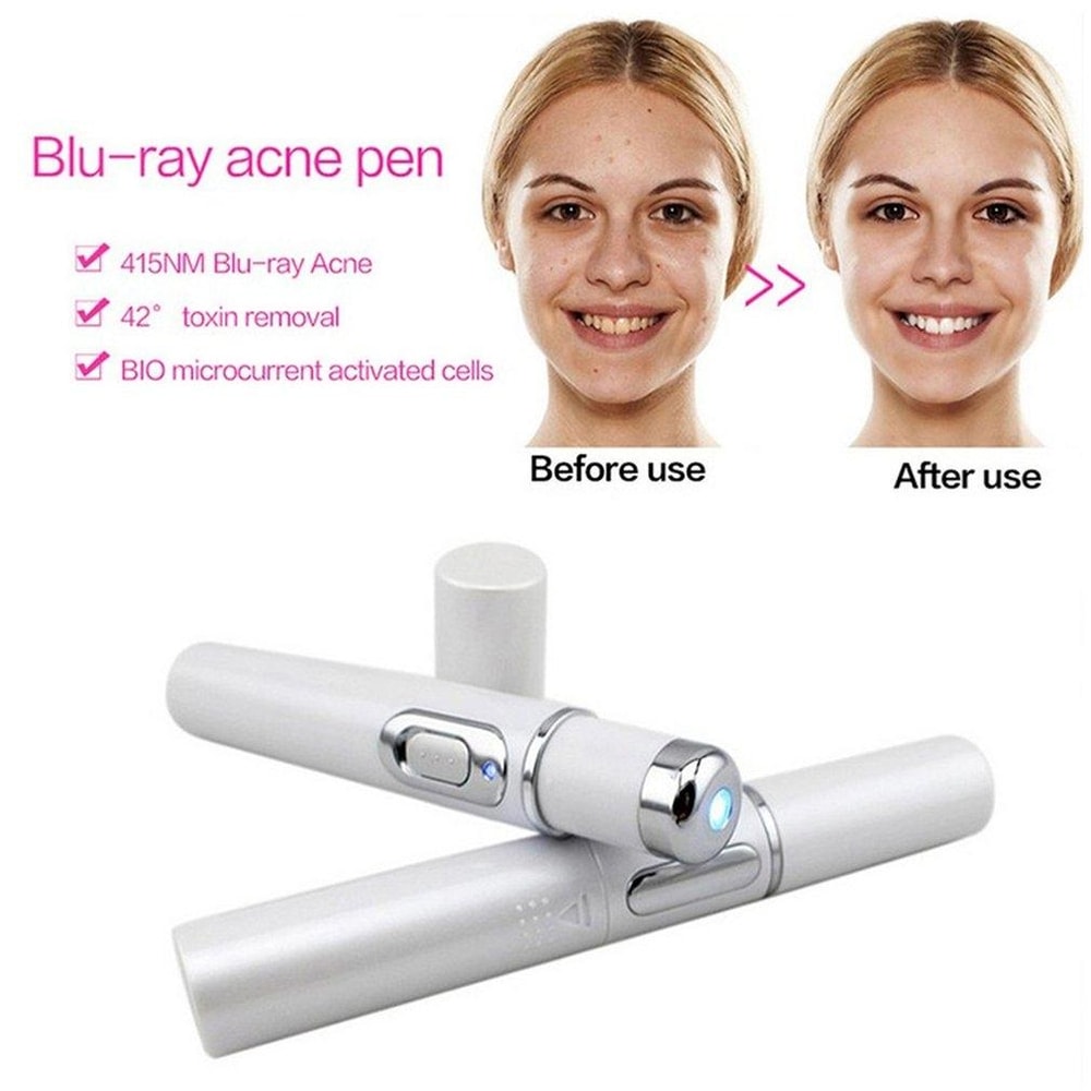 KSKIN Blue Light Acne Laser Pen Wrinkle Scar Removal Device For Clearer Smoother Skin 9