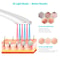 LED Acne Treatment Device With Blue Red Light Therapy Rechargeable Wand 1