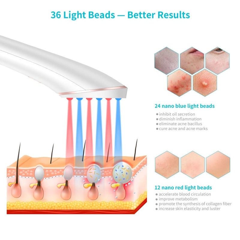 LED Acne Treatment Device With Blue Red Light Therapy Rechargeable Wand 1
