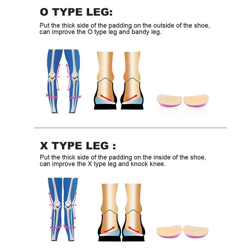 Orthopedic Heel Pads For OX Legs Flat Feet Posture Support 4