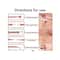 Precision Stainless Steel Blackhead Remover Tool Set For Acne Whiteheads Milia Extraction 3