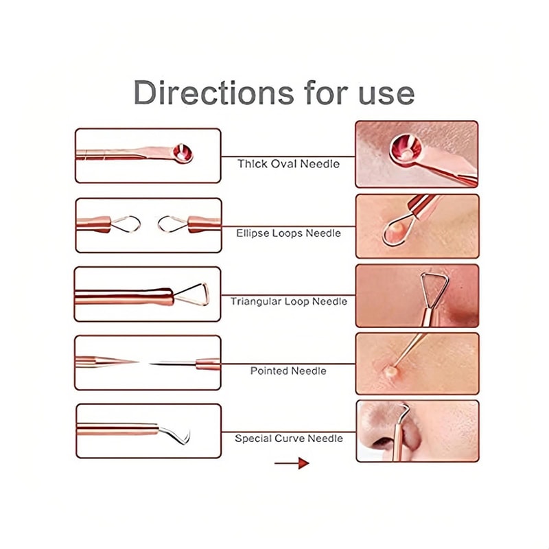 Precision Stainless Steel Blackhead Remover Tool Set For Acne Whiteheads Milia Extraction 3