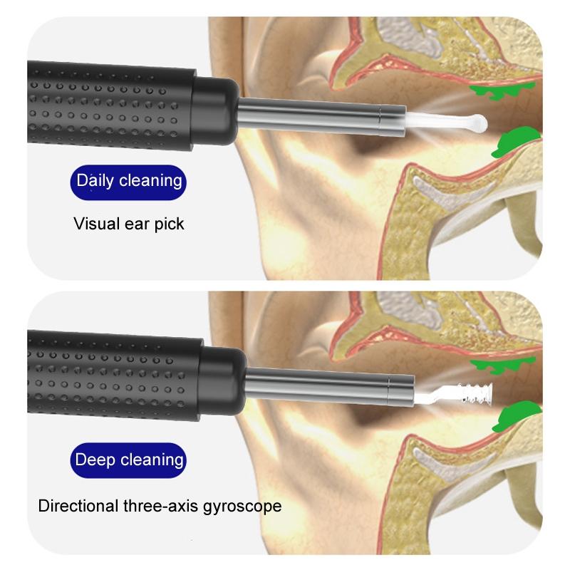 Smart Visual Ear Cleaner Endoscope Ear Wax Removal Tool With App View 3