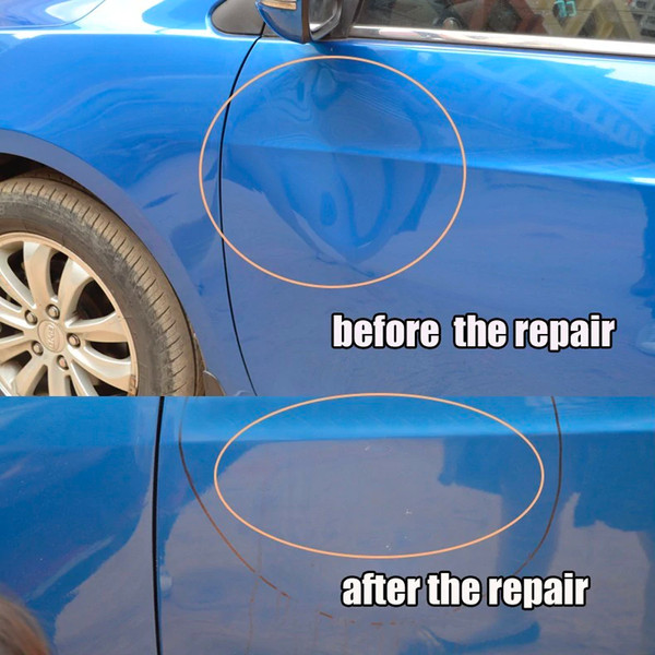 Car Dent Removal Tool Kit - Inspire Uplift